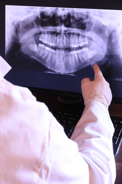 Best Emergency Treatment for Dental Infections or Abscesses in Baileys Crossroads, VA