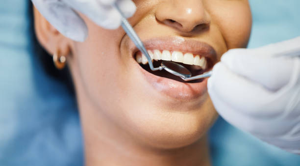 Best Urgent Care for Lost Fillings or Crowns in Baileys Crossroads, VA