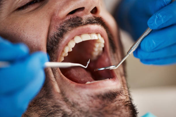 Best Pediatric Emergency Dentist in Baileys Crossroads, VA